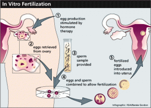 ivf