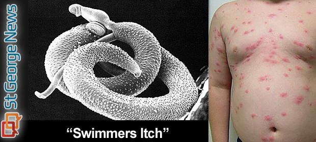 Swimmer's Itch - American Osteopathic College of ...