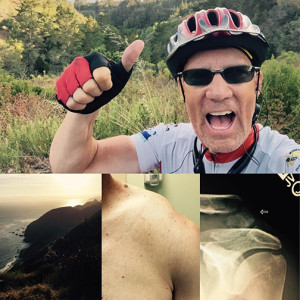 A compilation of photos including Jody Rich giving a "thumbs-up" for the camera , location not specified,  circa July 13-23, 2015; an ocean view - location not specified, circa July 13-23, 2015; a picture of Rich's broken clavicle, circa July 23, 2015;  and an X-ray from after his crash, circa July 23, 2015 | Compilation courtesy of Jody Rich, St. George News